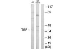 Western Blotting (WB) image for anti-Thyrotrophic Embryonic Factor (TEF) (AA 211-260) antibody (ABIN2889561) (TEF 抗体  (AA 211-260))