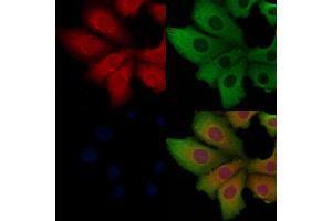 ABIN6262052 and ABIN6268767 staining Hela cells by IF/ICC. (O3FAR1 抗体  (Internal Region))