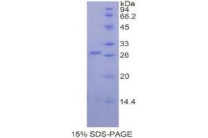 SDS-PAGE (SDS) image for Glutathione S-Transferase pi 1 (GSTP1) protein (ABIN3009644)