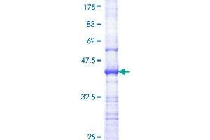 Image no. 1 for AXL Receptor tyrosine Kinase (AXL) (AA 30-140) protein (GST tag) (ABIN1346247) (AXL Protein (AA 30-140) (GST tag))