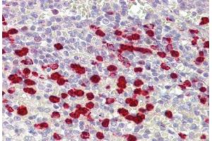 IHC Suggested Anti-ZNF746 antibody  Titration: 5ug/ ml Positive Control: Spleen (ZNF746 抗体  (Middle Region))