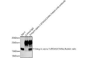 Immunoprecipitation analysis of 300 μg extracts of  cells using 3 μg Integrin alpha 5 (ITG/CD49e) antibody (ABIN7267936). (ITGA5 抗体)
