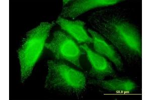 Immunofluorescence (IF) image for anti-Ring Finger Protein 14 (RNF14) (AA 217-316) antibody (ABIN564146)