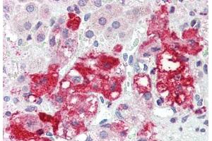 Human Adrenal (formalin-fixed, paraffin-embedded) stained with LASS6 antibody ABIN396945 at 5 ug/ml followed by biotinylated goat anti-rabbit IgG secondary antibody ABIN481713, alkaline phosphatase-streptavidin and chromogen. (CERS6 抗体  (N-Term))