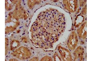 IHC image of ABIN7143601 diluted at 1:400 and staining in paraffin-embedded human kidney tissue performed on a Leica BondTM system. (AGRN 抗体  (AA 968-1130))