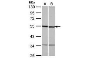 Image no. 1 for anti-Tubulin, beta 1 (TUBB1) (AA 14-260) antibody (ABIN1501568)