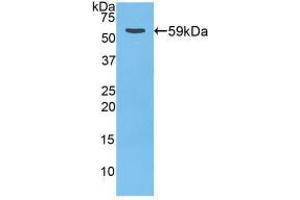 Western blot analysis of recombinant Rat CTSD. (Cathepsin D 抗体  (AA 120-407))