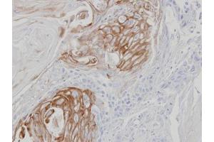 IHC-P Image Immunohistochemical analysis of paraffin-embedded SCC25 xenograft, using ZPBP, antibody at 1:100 dilution. (ZPBP 抗体)