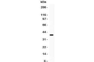 Western blot testing of HOXA11 antibody and recombinant human protein (0. (Homeobox A11 抗体  (AA 74-245))