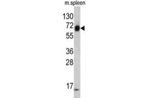 Western Blotting (WB) image for anti-Keratin 4 (KRT4) antibody (ABIN3002775)