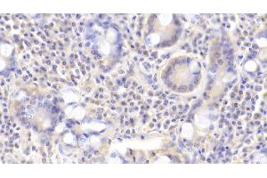 Detection of ROR1 in Human Small intestine Tissue using Polyclonal Antibody to Receptor Tyrosine Kinase Like Orphan Receptor 1 (ROR1) (ROR1 抗体  (AA 540-795))
