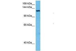 Host:  Rat  Target Name:  TRPM4  Sample Tissue:  Rat Brain  Antibody Dilution:  1ug/ml (TRPM4 抗体  (N-Term))