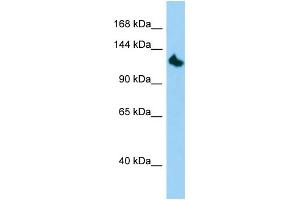 Host: Rabbit Target Name: KIF24 Sample Type: HepG2 Whole Cell lysates Antibody Dilution: 1.