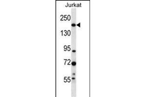 UGCGL1 Antibody (C-term) (ABIN657069 and ABIN2846232) western blot analysis in Jurkat cell line lysates (35 μg/lane). (UGGT1 抗体  (C-Term))
