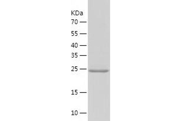 COX4NB Protein (AA 1-210) (His tag)