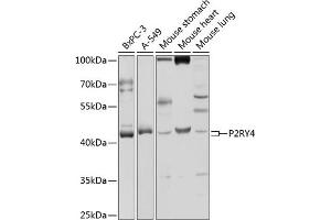 Western blot analysis of extracts of various cell lines, using P2RY4 antibody (ABIN3017281, ABIN3017282, ABIN3017283 and ABIN6220021) at 1:1000 dilution. (P2RY4 抗体  (AA 286-365))