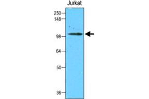 Western blot analysis of cell lysate of Jurkat (50 ug) was resolved by SDS - PAGE , transferred to NC membrane and probed with HK2 monoclonal antibody , clone 1A7 (1 : 2000) . (Hexokinase 2 抗体)