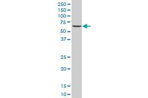 ZNF215 monoclonal antibody (M03), clone 1D12 Western Blot analysis of ZNF215 expression in A-431 . (ZNF215 抗体  (AA 1-304))