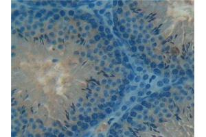 Immunohistochemistry (IHC) image for anti-Taxilin alpha (TXLNA) (AA 1-234) antibody (ABIN7442678)