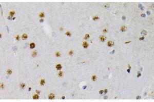 Immunohistochemistry of paraffin-embedded Rat brain using Phospho-CREB1(S133) Polyclonal Antibody at dilution of 1:200 (40x lens). (CREB1 抗体  (pSer133))