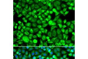 Immunofluorescence analysis of A549 cells using PSMB8 Polyclonal Antibody (PSMB8 抗体)