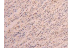 DAB staining on IHC-P; Samples: Human Spleen Tissue (PABPC1L 抗体  (AA 187-368))