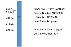 WB Suggested Anti-GTF2A1L  Antibody Titration: 0. (GTF2A1L 抗体  (C-Term))