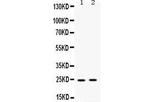 Western blot analysis of HMGB2 expression in rat liver extract ( Lane 1) and human placenta extract ( Lane 2). (HMGB2 抗体  (N-Term))