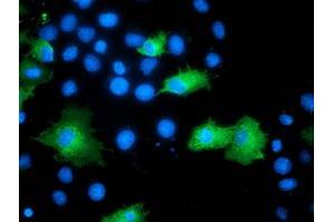 Anti-ARFGAP1 mouse monoclonal antibody (ABIN2454352) immunofluorescent staining of COS7 cells transiently transfected by pCMV6-ENTRY ARFGAP1 (RC206987). (ARFGAP1 抗体)