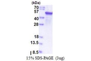 EPHX1 Protein (AA 21-455) (T7 tag)