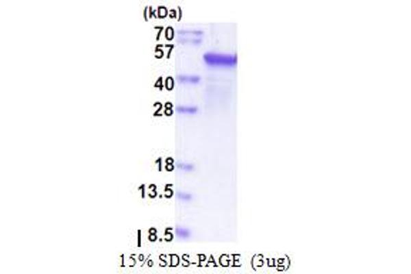 EPHX1 Protein (AA 21-455) (T7 tag)