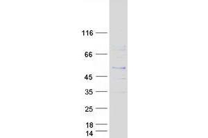 Western Blotting (WB) image for Proteasome (Prosome, Macropain) Subunit, beta Type, 8 (Large Multifunctional Peptidase 7) (PSMB8) (Transcript Variant 1) protein (Myc-DYKDDDDK Tag) (ABIN2729944)