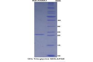 SDS-PAGE analysis of Rat PARK7 Protein. (PARK7/DJ1 蛋白)