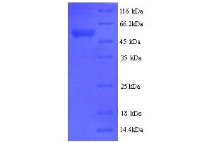 SDS-PAGE (SDS) image for Myelin Associated Glycoprotein (MAG) (AA 25-516), (Extracellular) protein (His tag) (ABIN5713622)