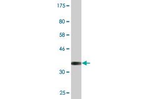 Western Blot detection against Immunogen (37. (RAPGEF3 抗体  (AA 772-881))