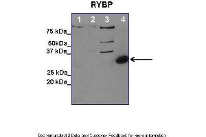 Lanes:   1. (RYBP 抗体  (Middle Region))