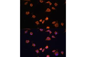 Immunofluorescence analysis of L929 cells using NF2 antibody (ABIN6128275, ABIN6144548, ABIN6144551 and ABIN7101344) at dilution of 1:100. (Merlin 抗体  (AA 477-576))