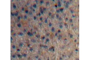 Used in DAB staining on fromalin fixed paraffin-embedded Liver tissue (Huntingtin 抗体  (AA 782-920))