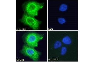 ABIN238540 Immunofluorescence analysis of paraformaldehyde fixed A431 cells, permeabilized with 0.