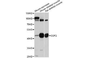 Western blot analysis of extracts of various cell lines, using GDF2 antibody (ABIN5997784) at 1/1000 dilution. (GDF2 抗体)
