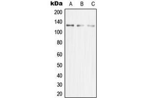 Western blot analysis of MCM2 expression in HeLa (A), Jurkat (B), HeLa (C) whole cell lysates. (MCM2 抗体  (N-Term))