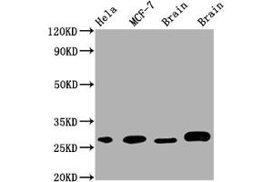 Western Blot Positive WB detected in: Hela whole cell lysate, MCF-7 whole cell lysate, Mouse Brain whole cell lysate, Rat Brain whole cell lysate All lanes: GRB2 antibody at 1:1000 Secondary Goat polyclonal to rabbit IgG at 1/50000 dilution Predicted band size: 26, 21 kDa Observed band size: 28 kDa (Recombinant GRB2 抗体)