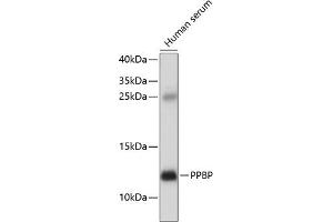Western blot analysis of extracts of human serum, using PPBP antibody  at 1:1000 dilution. (CXCL7 抗体  (AA 31-128))