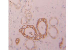 Immunohistochemistry (IHC) image for anti-Protein tyrosine Phosphatase, Receptor Type, G (PTPRG) (AA 848-1119) antibody (ABIN1870127)