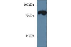 Western blot analysis of Mouse Skeletal muscle lysate, using Rat TRDN Antibody (1 µg/ml) and HRP-conjugated Goat Anti-Rabbit antibody ( (Triadin 抗体  (AA 486-687))