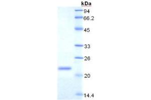 SDS-PAGE analysis of Rat Transferrin Receptor Protein. (Transferrin Receptor 蛋白)