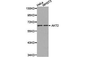 Western Blotting (WB) image for anti-V-Akt Murine Thymoma Viral Oncogene Homolog 2 (AKT2) antibody (ABIN1870912) (AKT2 抗体)