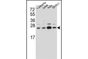 Western Blotting (WB) image for anti-Signal Sequence Receptor, beta (Translocon-Associated Protein Beta) (SSR2) (AA 154-183), (C-Term) antibody (ABIN657094)