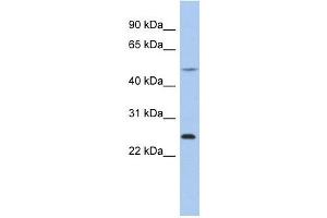 Chymotrypsinogen B1 antibody used at 1 ug/ml to detect target protein. (CTRB1 抗体  (N-Term))