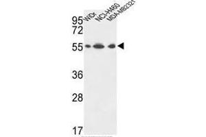 ATP5A1 Antibody (C-term) western blot analysis in WiDr,NCI-H460,MDA-MB231 cell line lysates (35µg/lane). (MT-ATP6 抗体  (C-Term, Subunit alpha))